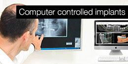 Computer-controlled implants