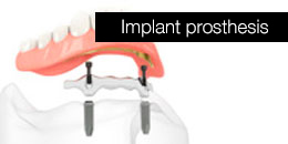 Implant prosthesis