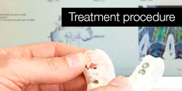 Treatment procedure